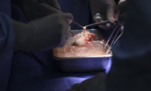 Así fue el primer trasplante de riñón de cerdo en un paciente vivo