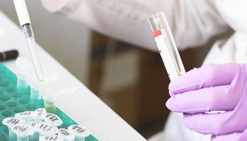 INTA y Senasa se suman a la realización de test de coronavirus