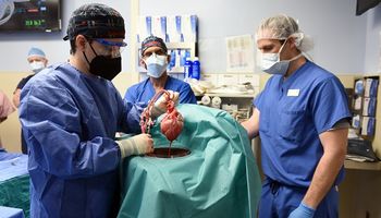 Operación histórica: se realizó el primer trasplante de corazón porcino a una persona