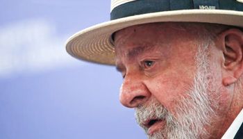 Lula faz novos exames e é liberado para retornar a Brasília